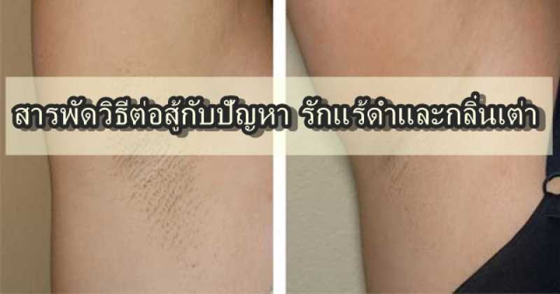 เคล็บลับ! สารพัดวิธีต่อสู้กับปัญหา รักแร้ดำและกลิ่นเต่า ( รีวิวจากชีวิตจริง )