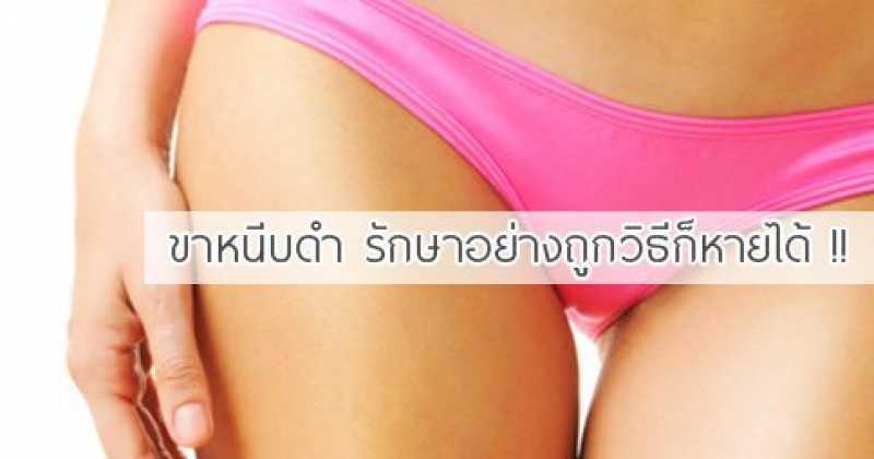 ขาหนีบดำทำไงดี!!? อ่านด่วนเรามีคำตอบมาให้ ทำง่ายๆเห็นผลแน่นอน.....